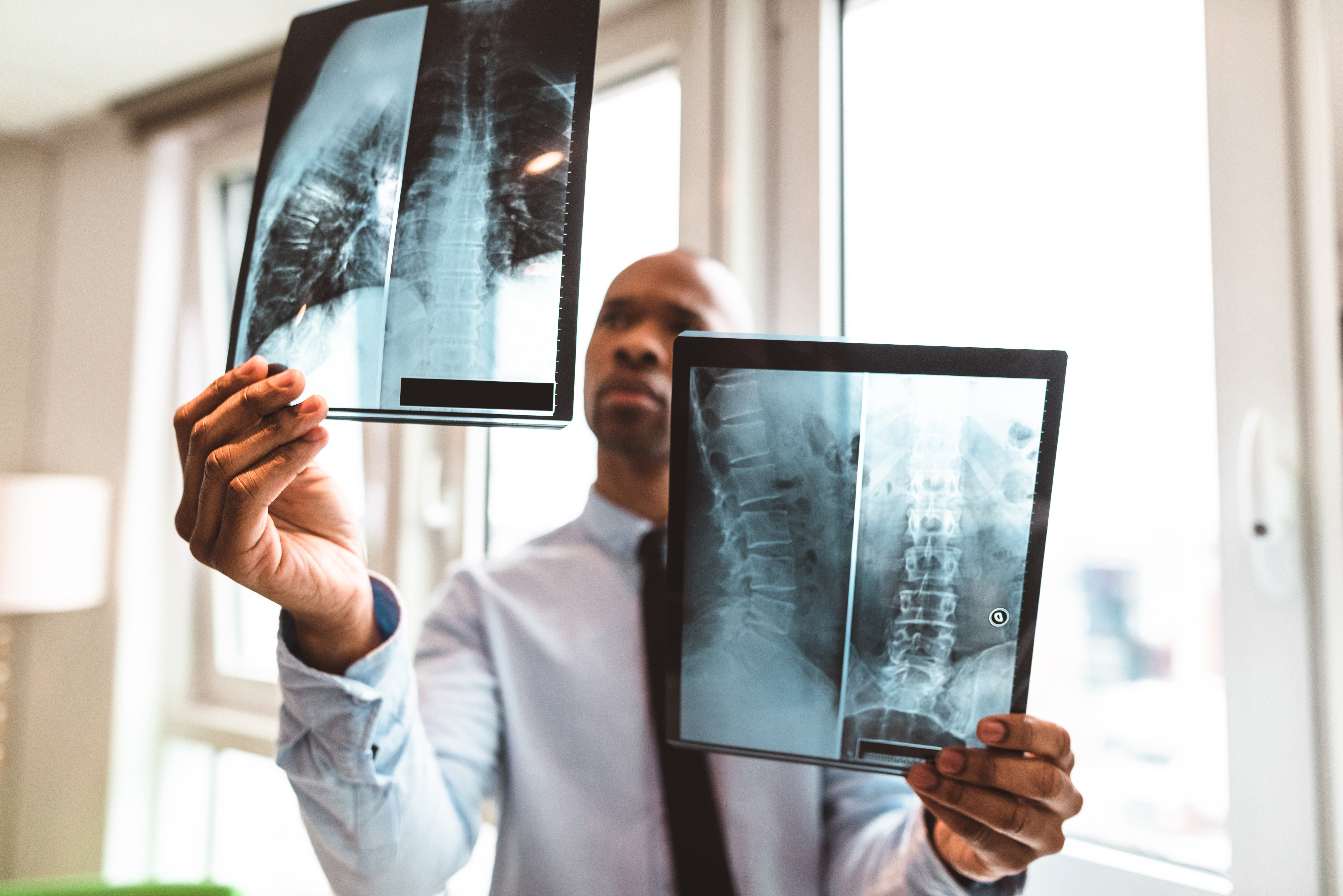 Healthcare professional holding x-ray scans up to the light analyzing spines